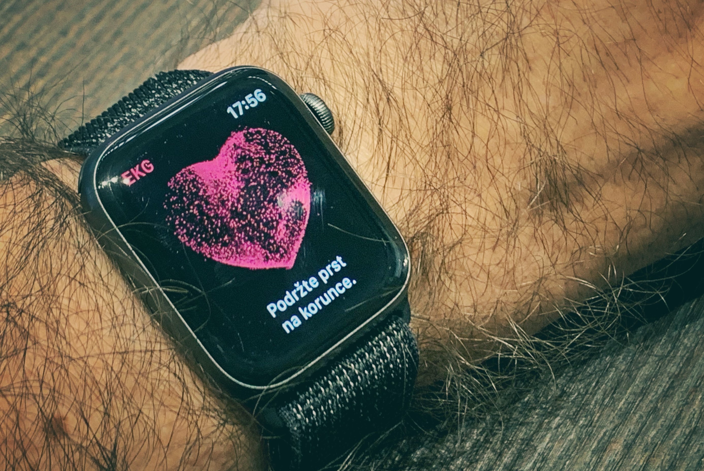 Apple Watch EKG